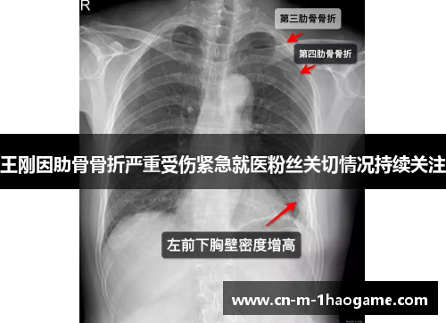 王刚因肋骨骨折严重受伤紧急就医粉丝关切情况持续关注 王刚因肋骨骨折严重受伤紧急就医粉丝关切情况持续关注